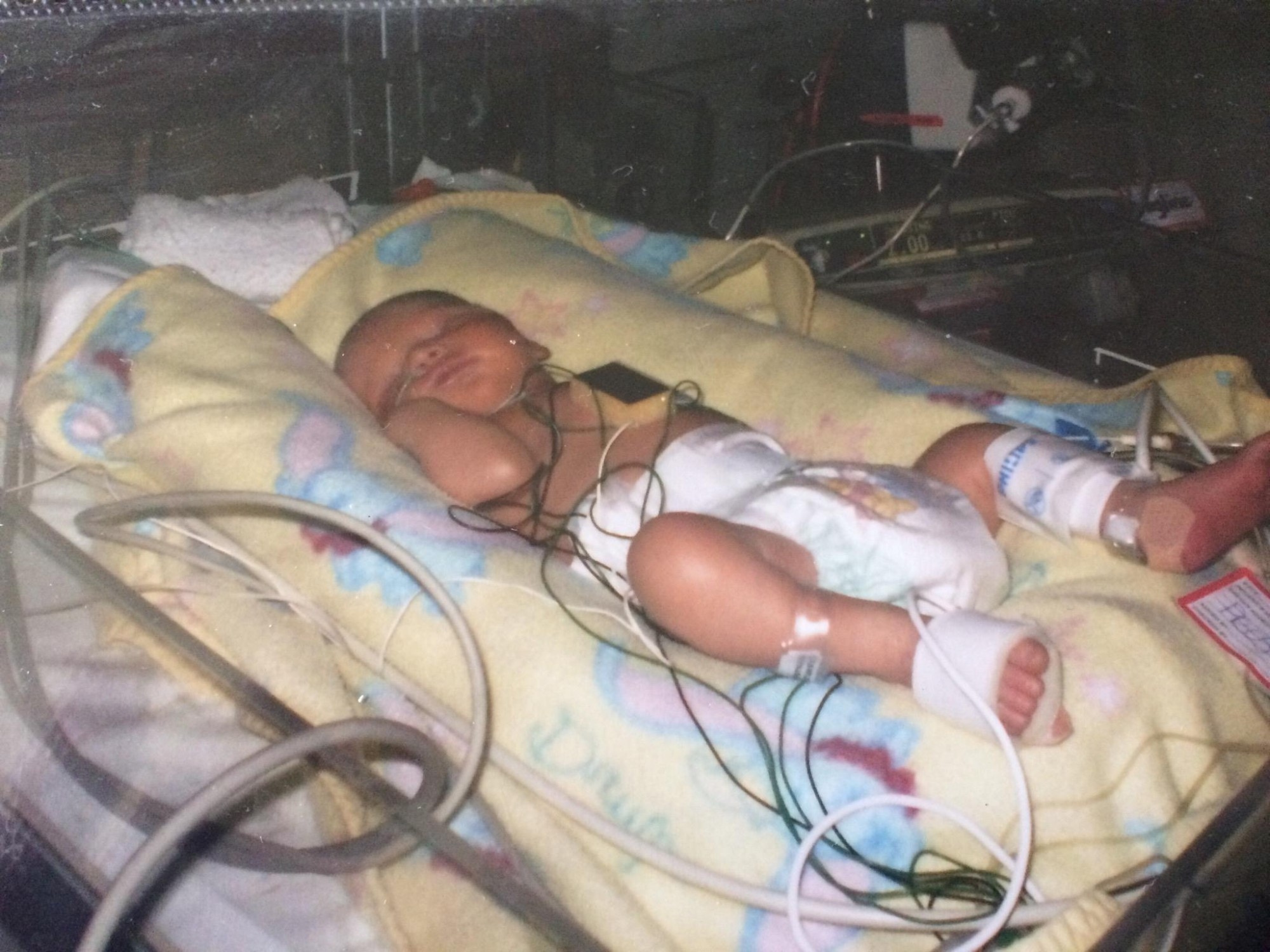 Be a hero: Terang’s Ben Crawley endured open heart surgery at just two-and-a-half weeks old, but is today a thriving teenager thanks in part to the efforts of HeartKids.